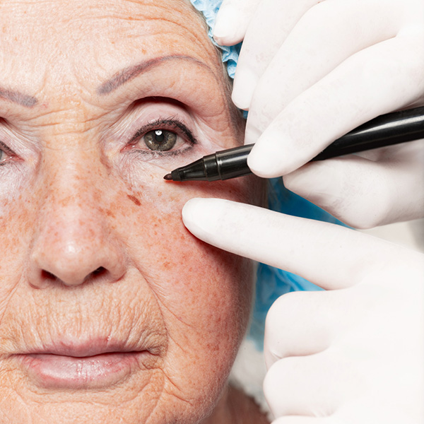 What is Anti Wrinkle Treatment?