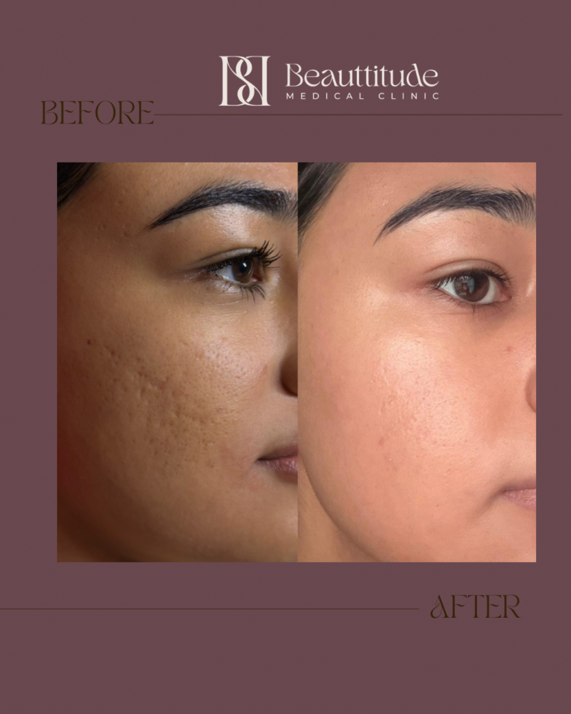 Beige Brown Neutral Before + After Instagram Post (Instagram Post (45)) - 1