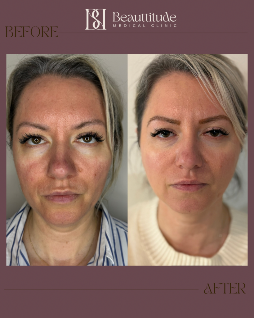 Beige Brown Neutral Before + After Instagram Post (Instagram Post (45)) - 10