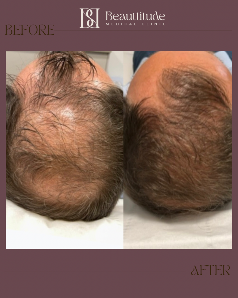 Beige Brown Neutral Before + After Instagram Post (Instagram Post (45)) - 11