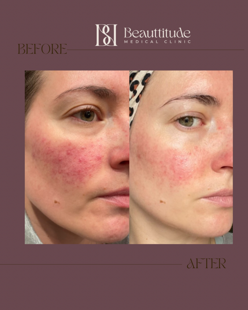 Beige Brown Neutral Before + After Instagram Post (Instagram Post (45)) - 2