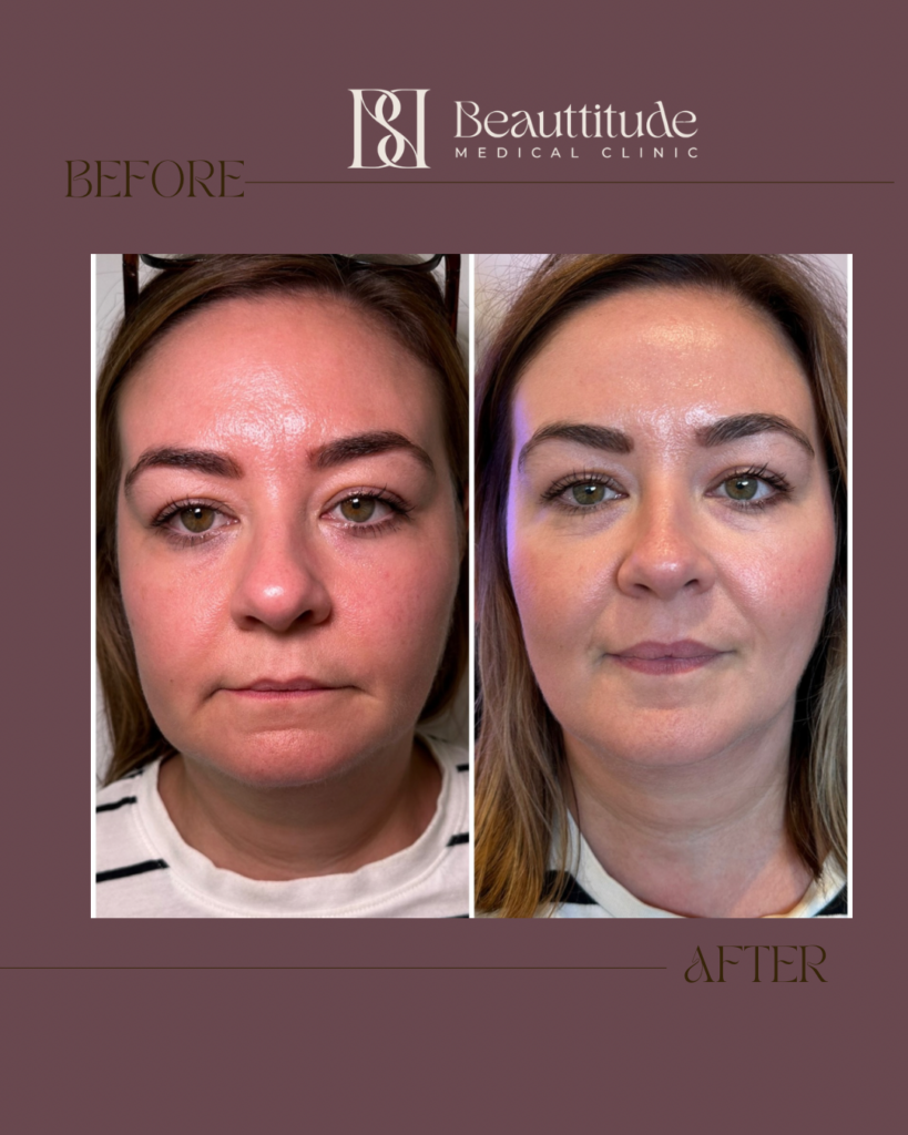 Beige Brown Neutral Before + After Instagram Post (Instagram Post (45)) - 3