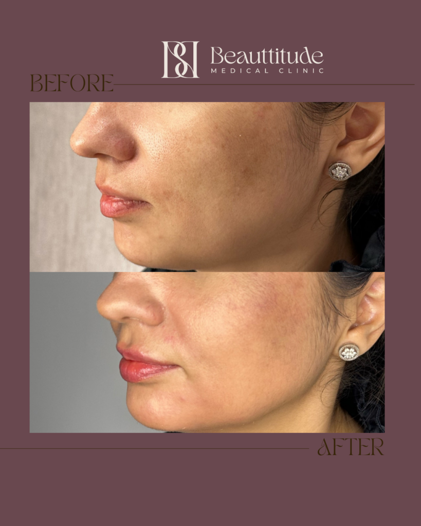 Beige Brown Neutral Before + After Instagram Post (Instagram Post (45)) - 4