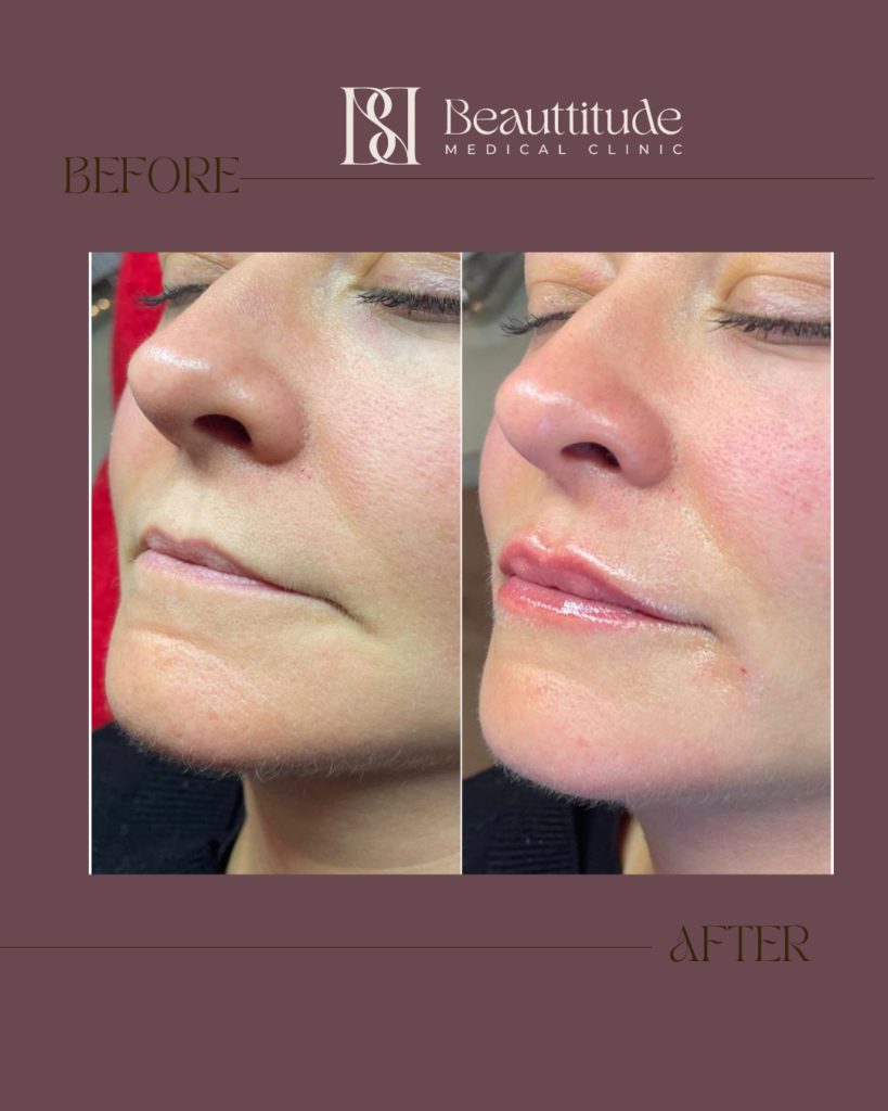 Beige Brown Neutral Before + After Instagram Post (Instagram Post (45)) - 5