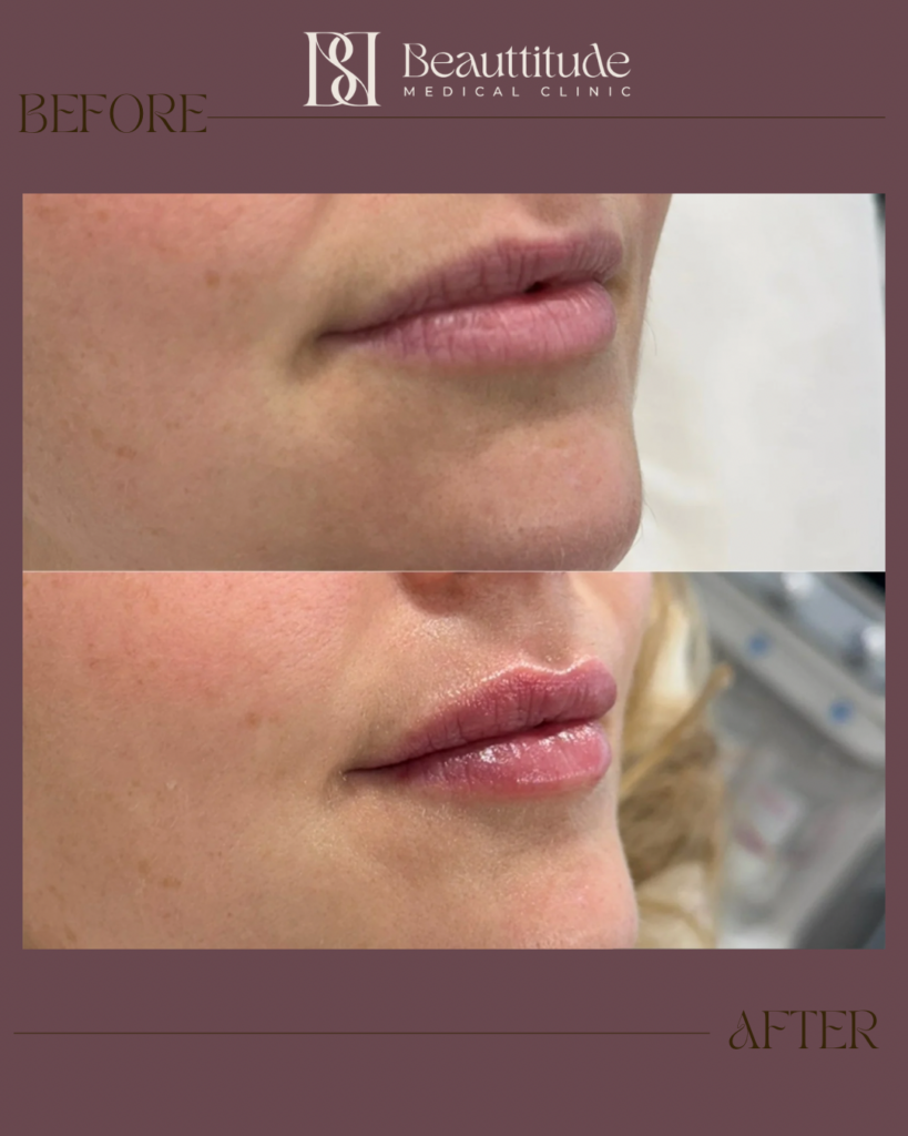 Beige Brown Neutral Before + After Instagram Post (Instagram Post (45)) - 7