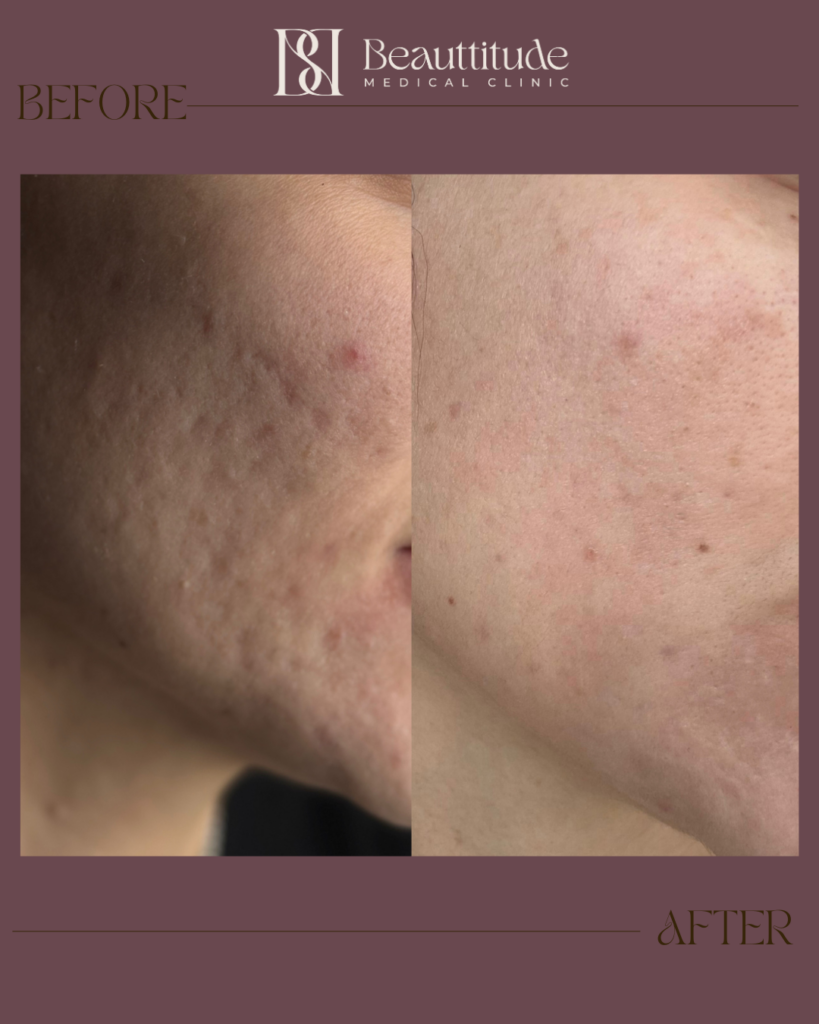 Beige Brown Neutral Before + After Instagram Post (Instagram Post (45)) - 9