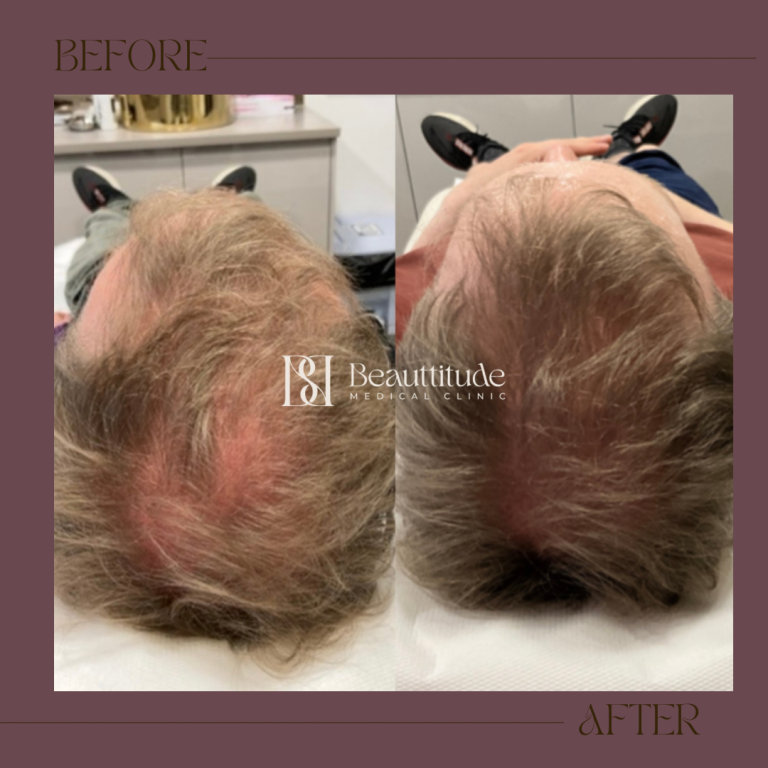 Beige Brown Neutral Before + After Instagram Post - 1