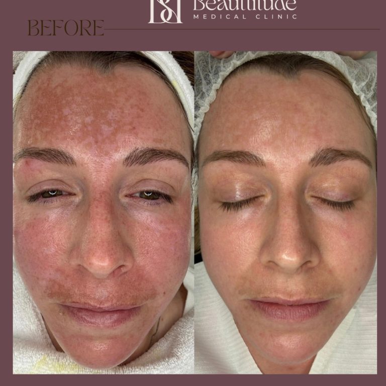 Beige Brown Neutral Before + After Instagram Post (Instagram Post (45)) - 1