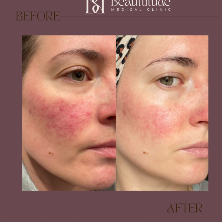 Beige Brown Neutral Before + After Instagram Post (Instagram Post (45)) - 2