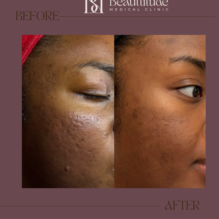 Beige Brown Neutral Before + After Instagram Post (Instagram Post (45)) - 6