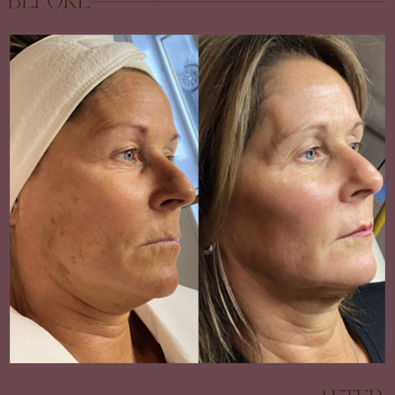 Beige Brown Neutral Before + After Instagram Post (Instagram Post (45))